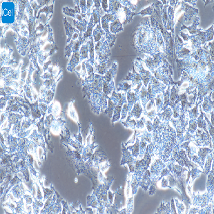 huh-7.5.1 人肝癌细胞（mdm-h107）