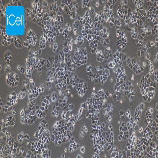 Caov-3 人卵巢腺癌细胞（mdm-h037）
