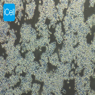 COLO320 人结直肠腺癌细胞(mdm-h046)