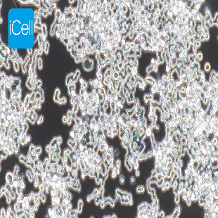 COLO320 DM人结直肠腺癌细胞（mdm-h047）