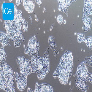 GS-HEPG2 人肝癌细胞亚型（mdm-h063）