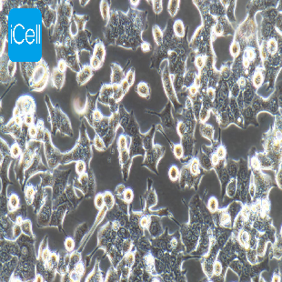 HEC-1-B 人子宫内膜腺癌细胞（mdm-h084）