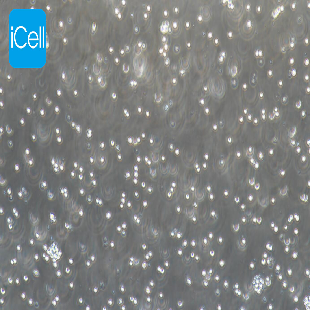 HEL 人红白细胞白血病细胞（mdm-h087）