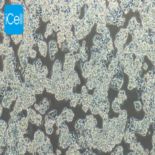 Hep G2.2.15 人肝癌(HBV) （mdm-h093）