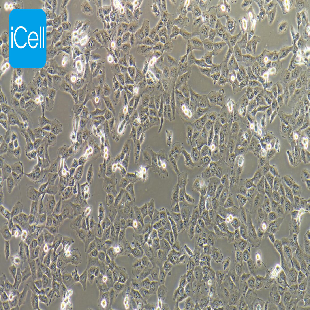 HT-1080 人纤维肉瘤细胞（mdm-h076）