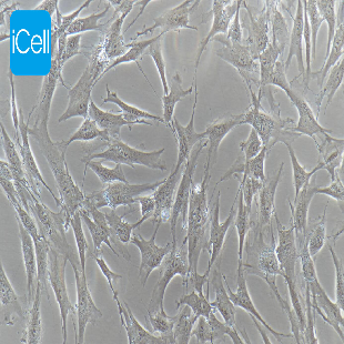 HTMC 人眼小梁网细胞（暂不提供）（mdm-h079）