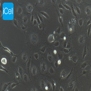 HUVEC 人脐静脉内皮细胞永生化（mdm-h110）