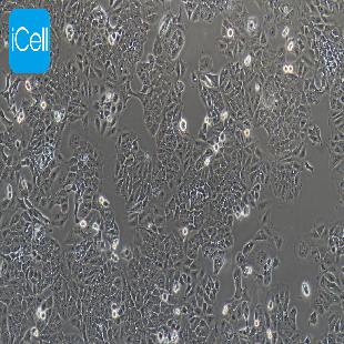 Ishikawa 人子宫内膜癌细胞（mdm-h113）