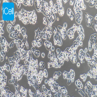 NCI-H1395 人肺腺癌细胞（mdm-h154）
