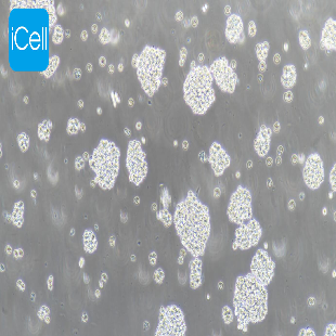 Jurkat（clone E6-1）人T淋巴细胞白血病细胞（mdm-h117）
