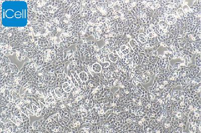 CX-1 人大肠癌细胞（mdm-h050）