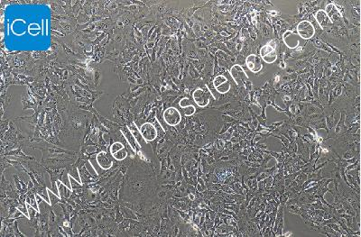 hccc-9810 人胆管细胞型肝癌细胞（mdm-h258）