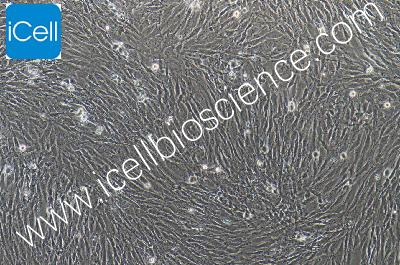 HSF(SV40转染) 人真皮成纤维细胞永生化（mdm-0051a）