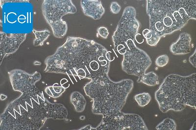 NCI-N87+luc 人胃癌细胞荧光素酶标记（mdm-0080a）