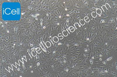 GBC-SD+luc 人胆囊癌细胞+luc（mdm-0025a）