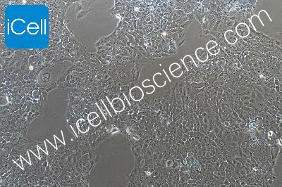 HCC827+luc 人非小细胞肺癌细胞荧光素酶标记（mdm-0073a）