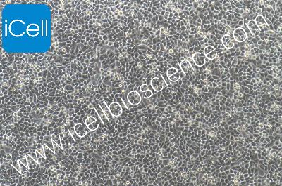 HELA+luc 人宫颈癌细胞 荧光素酶标记（mdm-0056a）