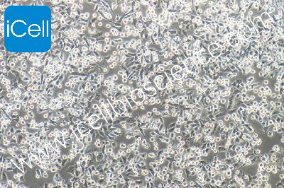 PATU 8988t 人胰腺癌细胞（mdm-h173）