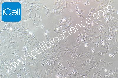 HS578T 人乳腺癌细胞（mdm-h105）