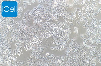 L-02人正常肝细胞（mdm-h054）