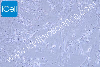 CCD841 CON 人正常结肠上皮细胞（有限细胞系）（mdm-h322）