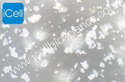 COLO320 HSR 人结直肠腺癌细胞（mdm-h048）