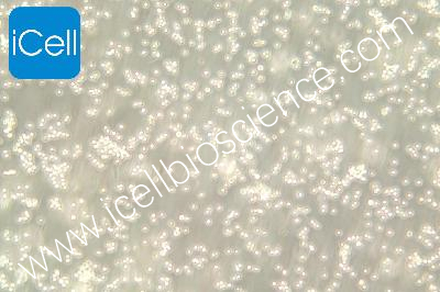 DAUDI 人Burkitt's淋巴瘤细胞（mdm-h052）