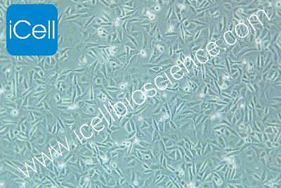 EJ （EJ-1）人膀胱癌细胞（mdm-h059）