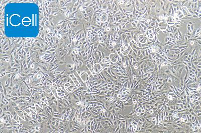 F56 人腺癌细胞系（mdm-h061）