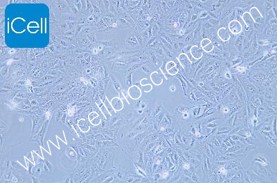 GBC-SD 人胆囊癌细胞（mdm-h281）