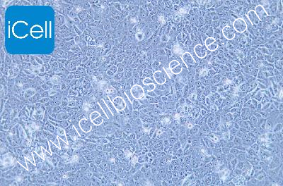 HCC-94 人子宫鳞癌细胞(高分化)（mdm-h069）