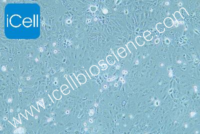 HuCCT1 人胆管癌细胞（mdm-h316）