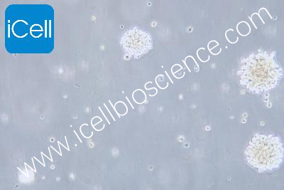 NK92 人恶性非霍奇金淋巴瘤患者的自然杀伤细胞（mdm-h0388）