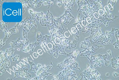 NCI-H295R 人肾上腺皮质腺癌细胞（mdm-h296）