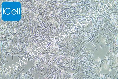 OCM1A 人眼脉络黑色素瘤细胞（mdm-h346）