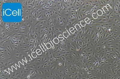 HUVEC+GFP 人脐静脉内皮细胞永生化+GFP（mdm-0022a）