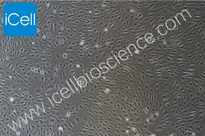 HUVEC+RFP 人脐静脉内皮细胞永生化+RFP（mdm-h111）