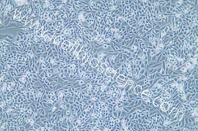 calu-6 人退行性癌细胞（mdm-h255）