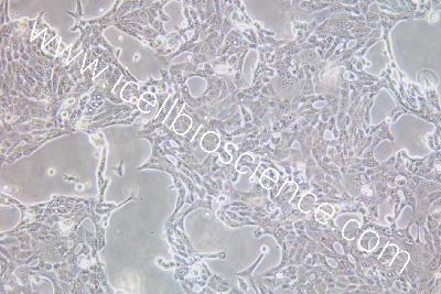 CFPAC-1 人胰腺癌细胞（mdm-h401）