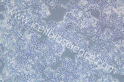 COV434 人卵巢颗粒肿瘤细胞（mdm-h383）