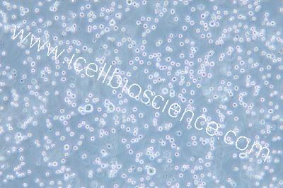 DB 人弥漫性大B细胞淋巴瘤细胞（mdm-h358）