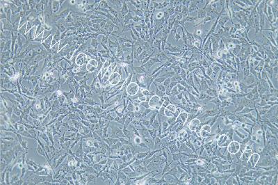 HEY 人卵巢癌细胞（mdm-h364）