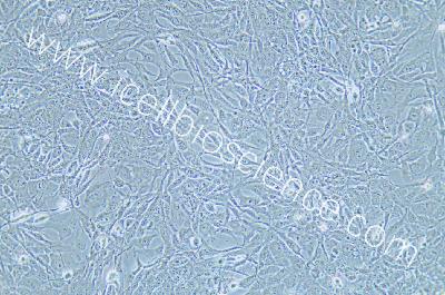 HEY A8 人卵巢癌细胞（mdm-h366）