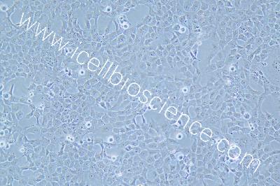 HTR-8/Svneo 人胚胎滋养细胞（mdm-h390）