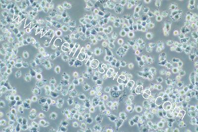 IHH4 人甲状腺乳头状癌细胞（mdm-h368）