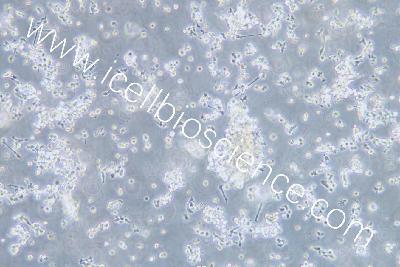 OCI-LY3 人弥漫大B细胞淋巴瘤细胞（mdm-h392）