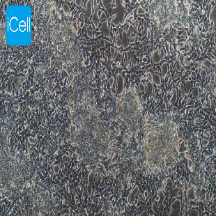 LNCaP clone FGC 人前列腺癌细胞(mdm-h125)